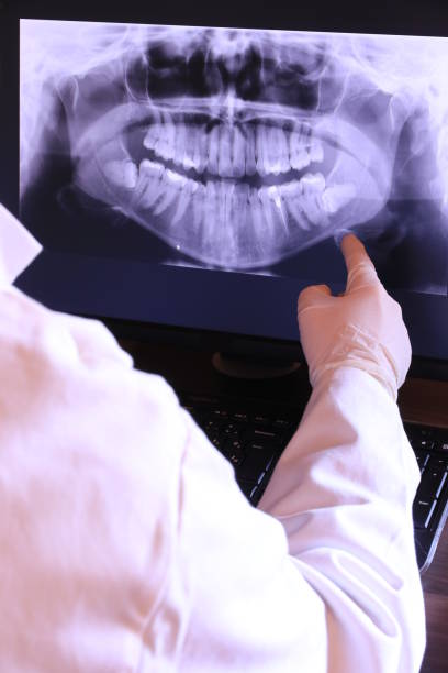 Best Emergency Tooth Extraction in Marillo, CA