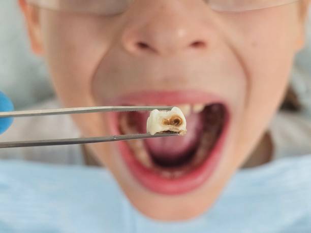 Best Emergency Orthodontic Repairs in Marillo, CA